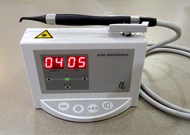 DIAGNOdent technology in Huntington Beach