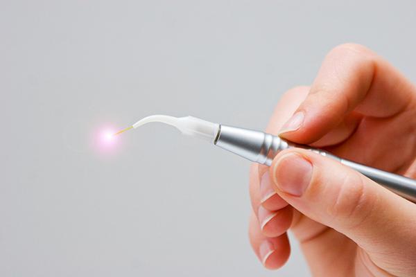 Laser gum therapy in Huntington Beach: Jason Cellars, DDS