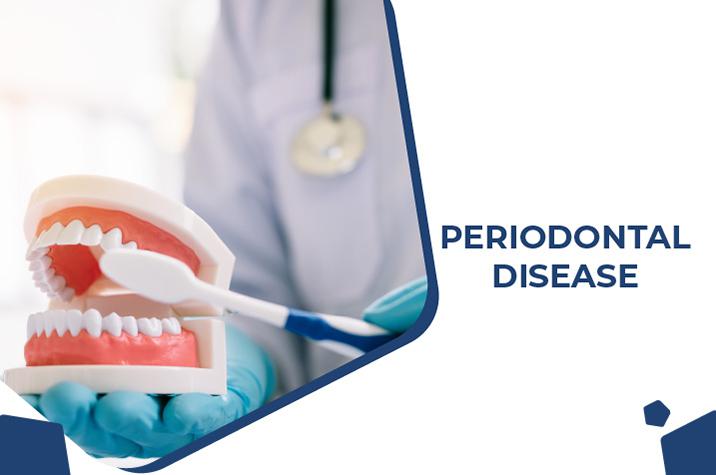 Periodontal Disease